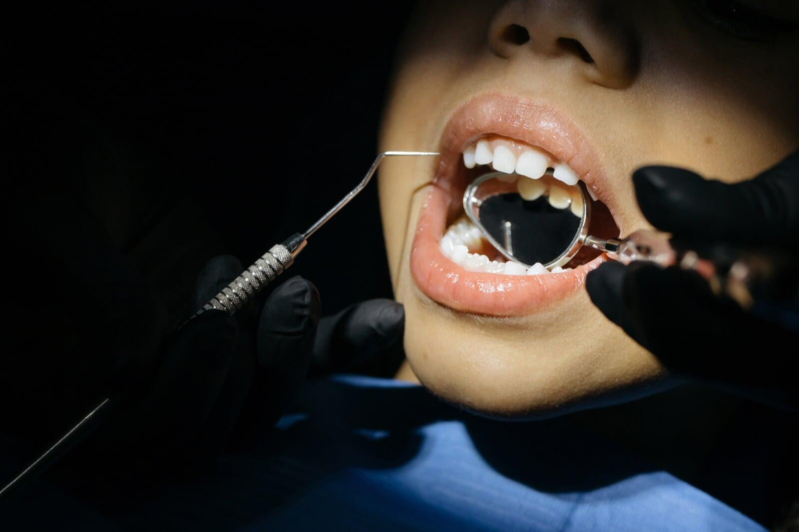 Mantenedores de Espacio: Importancia del Tratamiento y Relación Interdisciplinaria con la Odontopediatría para la Preservación del Espacio Dental en la Dentición Primaria